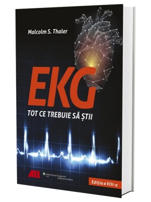 EKG - Tot ce trebuie să știi 