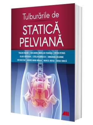 Tulburările de statică pelviană