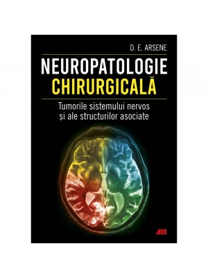 Neuropatologie chirurgicală. Tumorile sistemului nervos și ale structurilor asociate