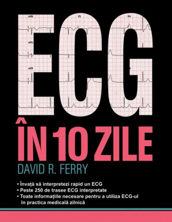 ECG